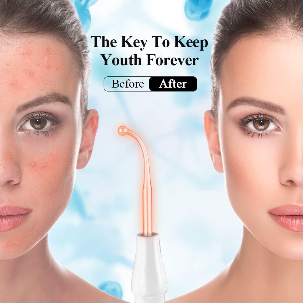Ulmars™ High Frequency Wand - Skin Hair Therapy Machine