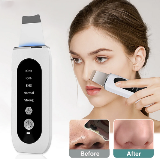 Ulmars™ Ultrasonic Skin Scrubber