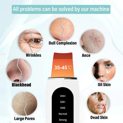 Ulmars™ Ultrasonic Skin Scrubber